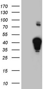 NHEJ1 / XLF Antibody - HEK293T cells were transfected with the pCMV6-ENTRY control (Left lane) or pCMV6-ENTRY NHEJ1 (Right lane) cDNA for 48 hrs and lysed. Equivalent amounts of cell lysates (5 ug per lane) were separated by SDS-PAGE and immunoblotted with anti-NHEJ1.