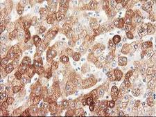 NHEJ1 / XLF Antibody - IHC of paraffin-embedded Human liver tissue using anti-NHEJ1 mouse monoclonal antibody. (Heat-induced epitope retrieval by 10mM citric buffer, pH6.0, 100C for 10min).