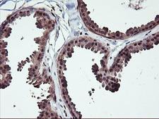 NHEJ1 / XLF Antibody - IHC of paraffin-embedded Human breast tissue using anti-NHEJ1 mouse monoclonal antibody.