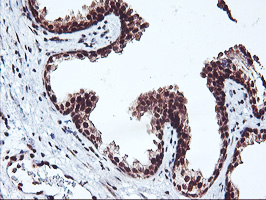 NHEJ1 / XLF Antibody - IHC of paraffin-embedded Human prostate tissue using anti-NHEJ1 mouse monoclonal antibody.