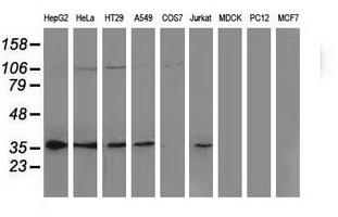 NHEJ1 / XLF Antibody - Western blot of extracts (35 ug) from 9 different cell lines by using anti-NHEJ1 monoclonal antibody.