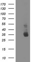 NHEJ1 / XLF Antibody - HEK293T cells were transfected with the pCMV6-ENTRY control (Left lane) or pCMV6-ENTRY NHEJ1 (Right lane) cDNA for 48 hrs and lysed. Equivalent amounts of cell lysates (5 ug per lane) were separated by SDS-PAGE and immunoblotted with anti-NHEJ1.