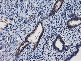 NHEJ1 / XLF Antibody - IHC of paraffin-embedded Human endometrium tissue using anti-NHEJ1 mouse monoclonal antibody.