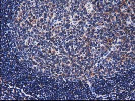 NHEJ1 / XLF Antibody - IHC of paraffin-embedded Human lymph node tissue using anti-NHEJ1 mouse monoclonal antibody.