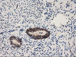 NHEJ1 / XLF Antibody - IHC of paraffin-embedded Human endometrium tissue using anti-NHEJ1 mouse monoclonal antibody.