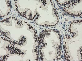 NHEJ1 / XLF Antibody - IHC of paraffin-embedded Human prostate tissue using anti-NHEJ1 mouse monoclonal antibody.