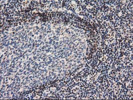 NHEJ1 / XLF Antibody - IHC of paraffin-embedded Human lymph node tissue using anti-NHEJ1 mouse monoclonal antibody.