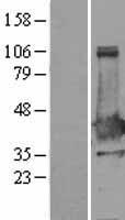 NHEJ1 / XLF Protein - Western validation with an anti-DDK antibody * L: Control HEK293 lysate R: Over-expression lysate