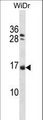 NHLH1 / HEN1 Antibody - NHLH1 Antibody western blot of WiDr cell line lysates (35 ug/lane). The NHLH1 antibody detected the NHLH1 protein (arrow).