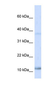 NHLH1 / HEN1 Antibody - NHLH1 antibody NHLH1(nescient helix loop helix 1) Antibody Western blot of Fetal Heart lysate.  This image was taken for the unconjugated form of this product. Other forms have not been tested.