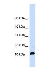 NHLH1 / HEN1 Antibody - Fetal brain lysate. Antibody concentration: 1.0 ug/ml. Gel concentration: 10-20%.  This image was taken for the unconjugated form of this product. Other forms have not been tested.