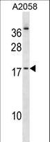 NHLH2 / HEN2 Antibody - NHLH2 Antibody western blot of A2058 cell line lysates (35 ug/lane). The NHLH2 antibody detected the NHLH2 protein (arrow).