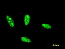 NHLH2 / HEN2 Antibody - Immunofluorescence of monoclonal antibody to NHLH2 on HeLa cell . [antibody concentration 10 ug/ml]