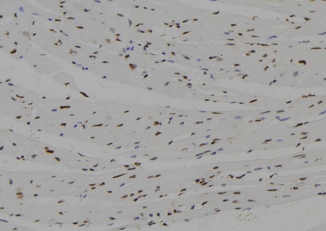 NHLH2 / HEN2 Antibody - 1:100 staining mouse heart tissue by IHC-P. The sample was formaldehyde fixed and a heat mediated antigen retrieval step in citrate buffer was performed. The sample was then blocked and incubated with the antibody for 1.5 hours at 22°C. An HRP conjugated goat anti-rabbit antibody was used as the secondary.