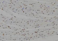 NHLH2 / HEN2 Antibody - 1:100 staining mouse heart tissue by IHC-P. The sample was formaldehyde fixed and a heat mediated antigen retrieval step in citrate buffer was performed. The sample was then blocked and incubated with the antibody for 1.5 hours at 22°C. An HRP conjugated goat anti-rabbit antibody was used as the secondary.
