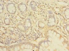 NHLRC2 Antibody - Immunohistochemistry of paraffin-embedded human small intestine tissue using antibody at dilution of 1:100.