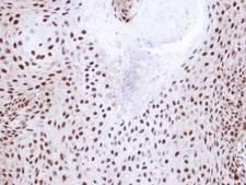 NHP2L1 Antibody - IHC of paraffin-embedded Cal27 xenograft using NHP2-like protein 1 antibody at 1:100 dilution.