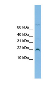 NHP2L1 Antibody - NHP2L1 antibody Western blot of OVCAR-3 cell lysate. This image was taken for the unconjugated form of this product. Other forms have not been tested.