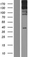 NHSL1 Protein - Western validation with an anti-DDK antibody * L: Control HEK293 lysate R: Over-expression lysate