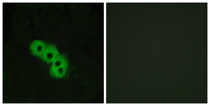 Niacin Receptor Antibody - Immunofluorescence analysis of MCF7 cells, using GPR109 Antibody. The picture on the right is blocked with the synthesized peptide.