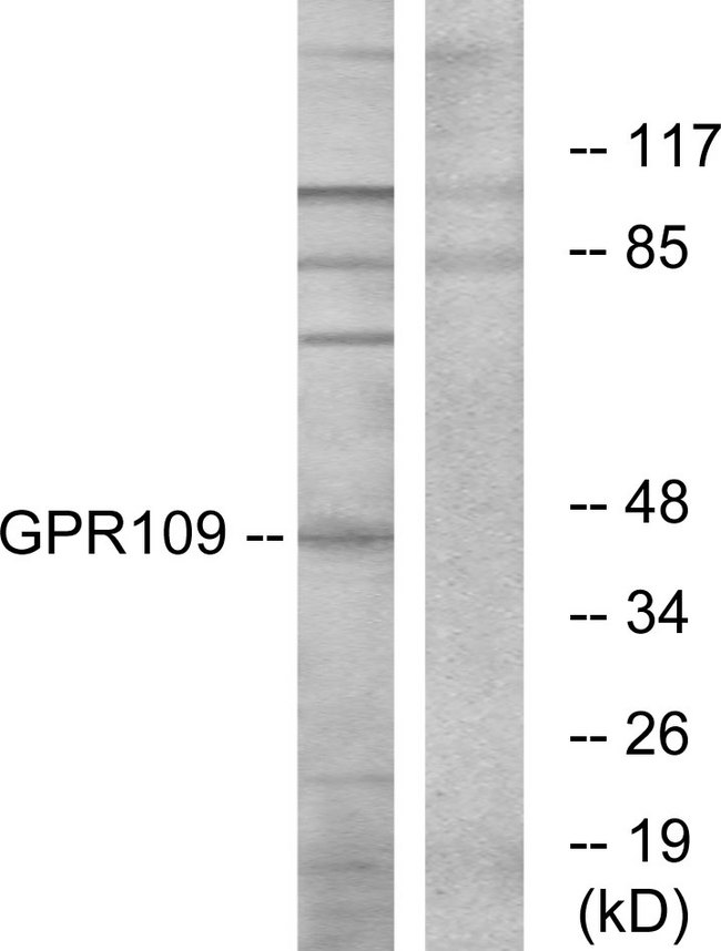 Niacin Receptor Antibody - Western blot analysis of lysates from RAW264.7 cells, using GPR109 Antibody. The lane on the right is blocked with the synthesized peptide.