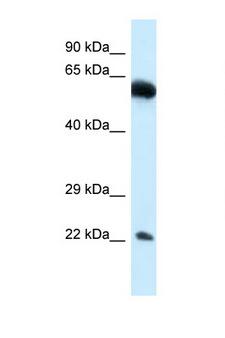 NICN1 Antibody - NICN1 antibody Western blot of 293T Cell lysate. Antibody concentration 1 ug/ml.  This image was taken for the unconjugated form of this product. Other forms have not been tested.