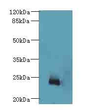 NICN1 Antibody - Western blot. All lanes: NICN1 antibody at 4 ug/ml+U84- whole cell lysate Goat polyclonal to rabbit at 1:10000 dilution. Predicted band size: 24 kDa. Observed band size: 24 kDa.