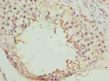 NICN1 Antibody - Immunohistochemistry of paraffin-embedded human testis tissue using antibody at dilution of 1:100.