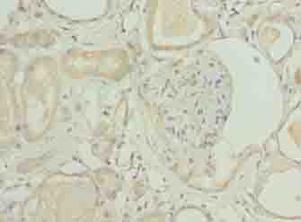 NICN1 Antibody - Immunohistochemistry of paraffin-embedded human kidney tissue using antibody at dilution of 1:100.