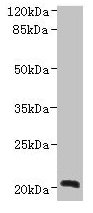 NICN1 Antibody - Western blot All lanes: NICN1 antibody at 4µg/ml + U937 whole cell lysate Secondary Goat polyclonal to rabbit IgG at 1/10000 dilution Predicted band size: 25, 20 kDa Observed band size: 20 kDa