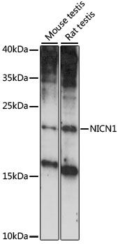 NICN1 Antibody - Western blot analysis of extracts of various cell lines, using NICN1 antibody at 1:1000 dilution. The secondary antibody used was an HRP Goat Anti-Rabbit IgG (H+L) at 1:10000 dilution. Lysates were loaded 25ug per lane and 3% nonfat dry milk in TBST was used for blocking. An ECL Kit was used for detection and the exposure time was 90s.