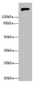 NID1 / Entactin / Nidogen-1 Antibody - Western blot All lanes: Nidogen-1 antibody at 6µg/ml + Rat lung tissue Secondary Goat polyclonal to rabbit IgG at 1/10000 dilution Predicted band size: 137 kDa Observed band size: 150 kDa