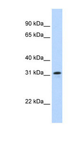 NIFK / MKI67IP Antibody - MKI67IP antibody Western blot of Fetal Thymus lysate. This image was taken for the unconjugated form of this product. Other forms have not been tested.
