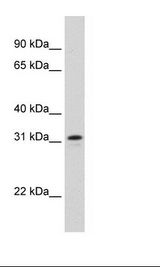 NIFK / MKI67IP Antibody - Fetal Thymus Lysate.  This image was taken for the unconjugated form of this product. Other forms have not been tested.