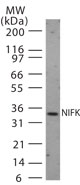 NIFK / MKI67IP Antibody - Western blot of NIFK in 30 ugs of HeLa cell lysate using antibody at 1:1000.