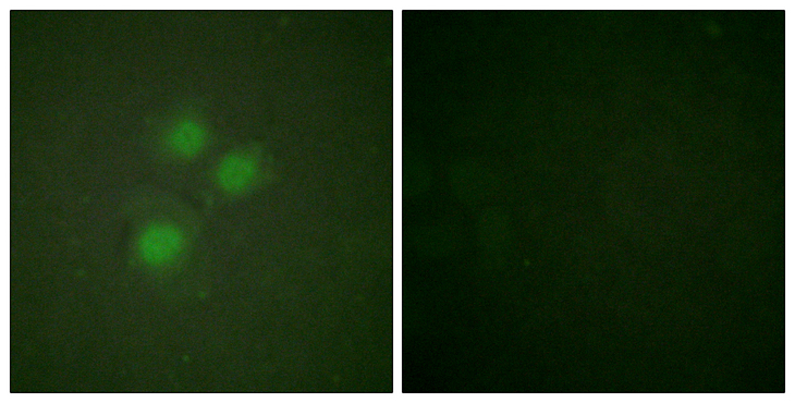 NIFK / MKI67IP Antibody - Immunofluorescence analysis of HUVEC cells, using NIFK Antibody. The picture on the right is blocked with the synthesized peptide.