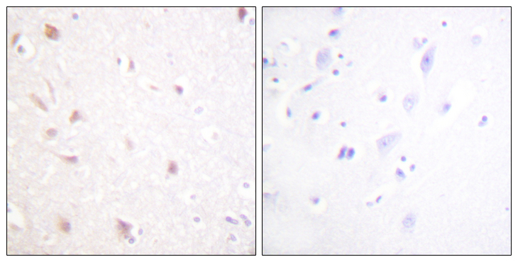 NIFK / MKI67IP Antibody - Immunohistochemistry analysis of paraffin-embedded human brain tissue, using NIFK Antibody. The picture on the right is blocked with the synthesized peptide.