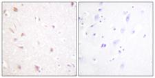 NIFK / MKI67IP Antibody - Immunohistochemistry analysis of paraffin-embedded human brain tissue, using NIFK Antibody. The picture on the right is blocked with the synthesized peptide.
