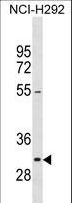 NIFK / MKI67IP Antibody - MKI67IP Antibody western blot of NCI-H292 cell line lysates (35 ug/lane). The MKI67IP antibody detected the MKI67IP protein (arrow).