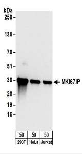 NIFK / MKI67IP Antibody - Detection of Human MKI67IP by Western Blot. Samples: Whole cell lysate (50 ug) from 293T, HeLa, and Jurkat cells. Antibodies: Affinity purified rabbit anti-MKI67IP antibody used for WB at 0.04 ug/ml. Detection: Chemiluminescence with an exposure time of 10 seconds.