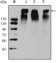 NIFK / MKI67IP Antibody - Western blot using KI67 mouse monoclonal antibody against HeLa (1), MCF-7 (2) and Raji (3) cell lysate.
