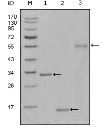 NIFK / MKI67IP Antibody - Western blot using Ki67 mouse monoclonal antibody against truncated Trx-Ki67 recombinant protein(1),truncated Ki67 (aa3118-3256)-His recombinant protein(2) and truncated Ki67 (aa3118-3256)-hIgGFc transfected CHO-K1 cell lysate(3).