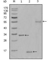 NIFK / MKI67IP Antibody - Western blot using Ki67 mouse monoclonal antibody against truncated Trx-Ki67 recombinant protein(1),truncated Ki67 (aa3118-3256)-His recombinant protein(2) and truncated Ki67 (aa3118-3256)-hIgGFc transfected CHO-K1 cell lysate(3).
