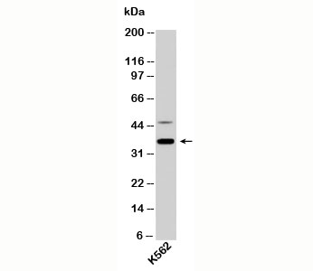 NIFK / MKI67IP Antibody - NIFK Antibody western blot of human samples
