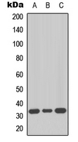NIFK / MKI67IP Antibody - Western blot analysis of MKI67IP expression in HeLa (A); SW480 (B); HepG2 (C) whole cell lysates.