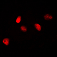 NIFK / MKI67IP Antibody - Immunofluorescent analysis of MKI67IP staining in HeLa cells. Formalin-fixed cells were permeabilized with 0.1% Triton X-100 in TBS for 5-10 minutes and blocked with 3% BSA-PBS for 30 minutes at room temperature. Cells were probed with the primary antibody in 3% BSA-PBS and incubated overnight at 4 deg C in a humidified chamber. Cells were washed with PBST and incubated with a DyLight 594-conjugated secondary antibody (red) in PBS at room temperature in the dark. DAPI was used to stain the cell nuclei (blue).