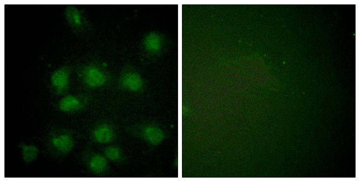 NIFK / MKI67IP Antibody - Immunofluorescence analysis of HUVEC cells, using NIFK (Phospho-Thr234) Antibody. The picture on the right is blocked with the phospho peptide.
