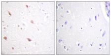 NIFK / MKI67IP Antibody - Immunohistochemistry analysis of paraffin-embedded human brain, using NIFK (Phospho-Thr234) Antibody. The picture on the right is blocked with the phospho peptide.