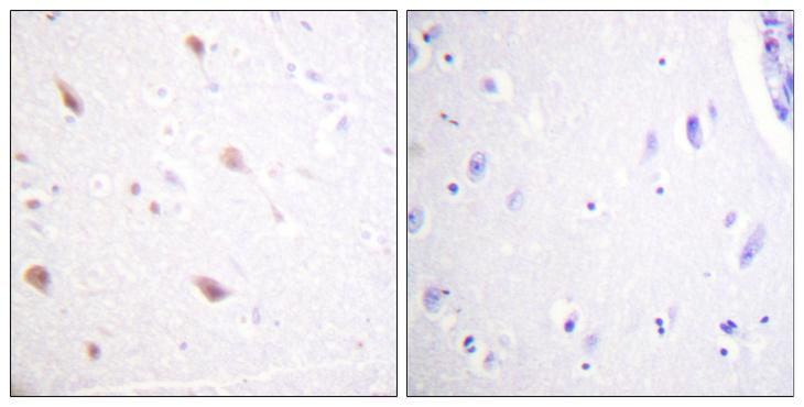 NIFK / MKI67IP Antibody - Peptide - + Immunohistochemistry analysis of paraffin-embedded human brain tissue using NIFK (Phospho-Thr234) antibody.