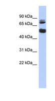 NIM1K / NIM1 Antibody - NIM1 / MGC42105 antibody Western blot of Jurkat lysate. This image was taken for the unconjugated form of this product. Other forms have not been tested.